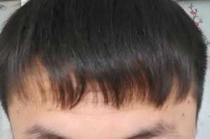 为什么头发长得很慢（为什么头发长得很慢呀）