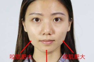 咬肌大是什么脸型,大圆脸什么样