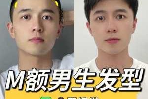 m发际线怎么办（m发际线怎么补救学生党）