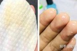 怎么洗去黑头（黑头清理方法）