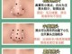 鼻头黑头怎么去除,鼻头黑头怎么去除最有效小妙招