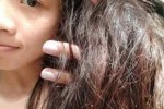 头发脆弱容易掉怎么办（头发脆弱易断能不能软化剂）