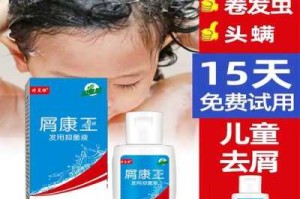 头屑严重选哪个洗发水,头皮屑很多用什么洗发水好呢