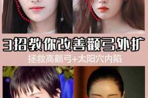 额骨大怎么办（额骨大怎么改善）