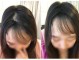 前额秃怎么办（前额秃怎么办女生）
