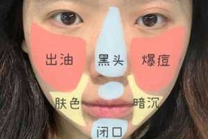 面部毛孔堵塞怎么办（面部毛孔堵塞怎么办小妙招）