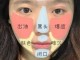 面部毛孔堵塞怎么办（面部毛孔堵塞怎么办小妙招）