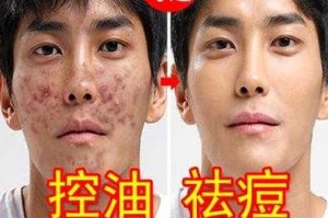 用什么洗脸可以有效祛除痘印,用什么洗脸能去痘印吗