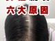 女人脱发严重是怎么回事,女生为什么脱发严重怎么办