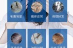 头皮屑的由来,头屑是怎么产生的原因