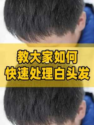 白发怎么治，能除根吗，谢谢了,白头发怎么治疗能彻底除根