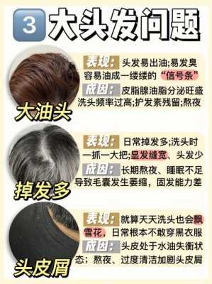 洗头掉头发是什么原因（为什么有些洗发露用了会掉发）