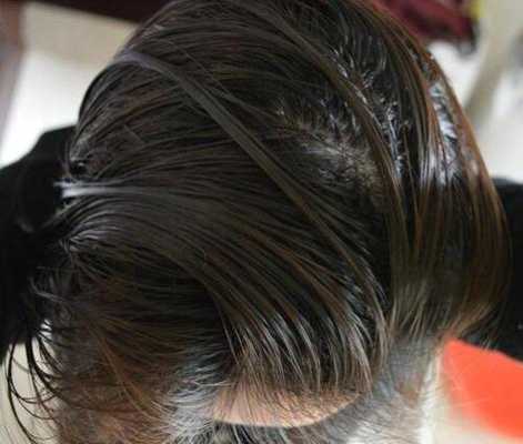 头发油腻怎么解决（头发油腻怎么解决小妙招）