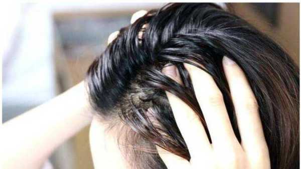 头发油腻怎么解决（头发油腻怎么解决小妙招）