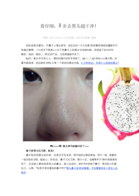 怎么去黑头小窍门（去黑头方法）