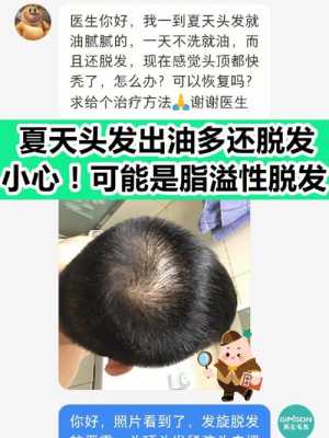 长头发掉发严重怎么办（长头发掉发严重怎么办药物）