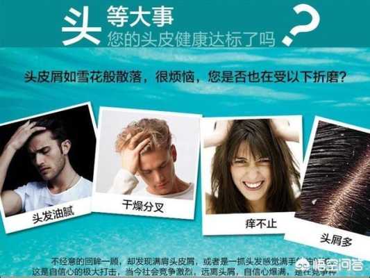 去屑小方法,怎么才能减少头皮屑的方法