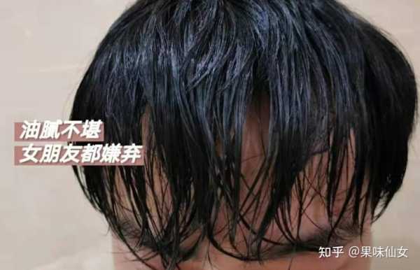 发质不好怎么改善,男生发质不好怎么改善