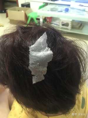 怎么去除头皮屑（怎么去除头皮屑最有效方法）