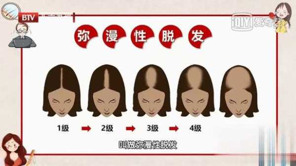 什么原因导致脱发（什么原因导致脱发严重女性）