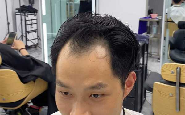 m型发际线适合什么发型（m型发际线适合什么发型）
