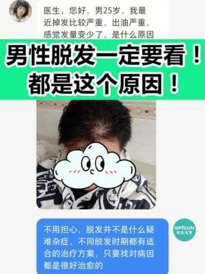 掉头发严重是什么原因（掉头发严重是什么原因男性）