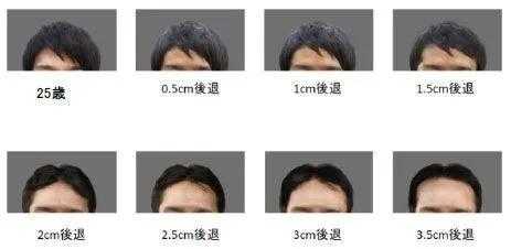 男生发际线高和什么有关,男人发际线高说明什么问题