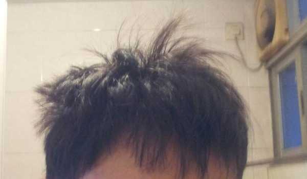 早上起来头发翘怎么办（男生早上起来头发翘怎么办）