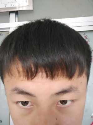 头发长得慢是什么原因（头发长得慢是什么原因造成的）