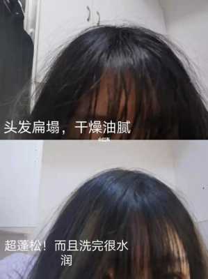 头发油得快怎么办（冬天头发油得快怎么办）