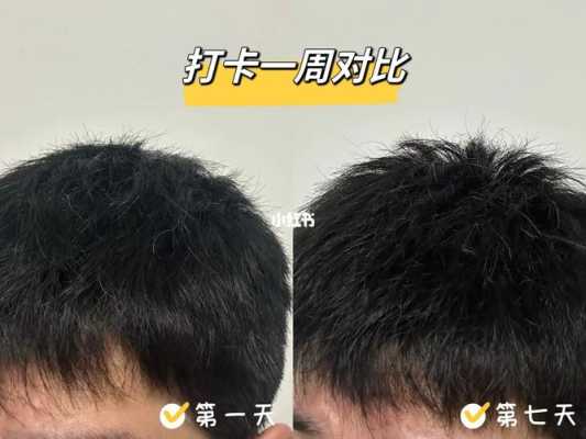 头发怎么变黑（头发怎么变黑最快最有效的方法）