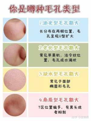 毛孔大怎么办（毛孔大怎么办 什么可以收缩毛孔）