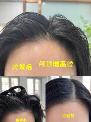 头发贴头皮是什么原因（头发太贴了怎么办）