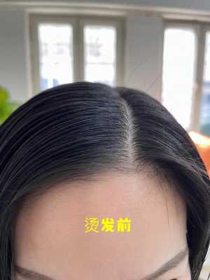 头发贴头皮是什么原因（头发太贴了怎么办）