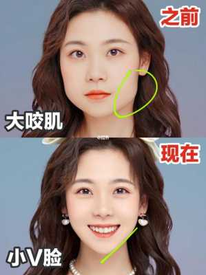 胖脸怎么变瘦脸（脸上肉多如何瘦脸）