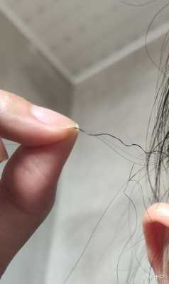 为什么我的头发长得又快又硬,有几根头发又粗又硬怎么回事