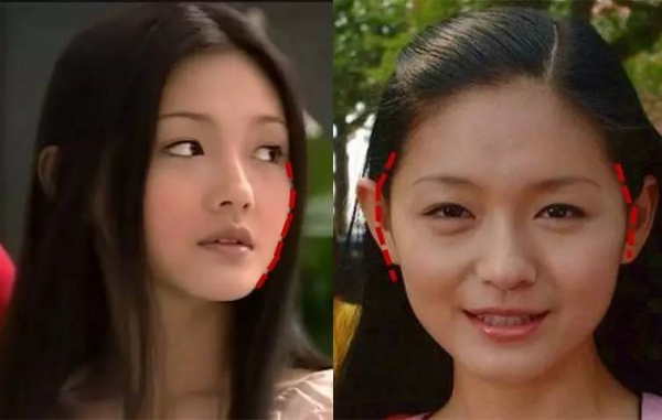 脸大颧骨大怎么办,颧骨横向宽的女人面相