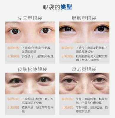 如何遮黑眼圈眼袋,怎么去黑眼圈和眼袋的简单方法学生