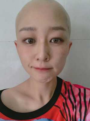 一周头发长10厘米有何秘诀,化疗后吃什么长头发长得快
