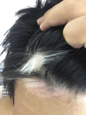 头发白什么原因（头发白什么原因导致的怎么调理）