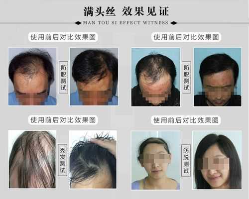 头发怎么变硬（怎么使头发变硬）