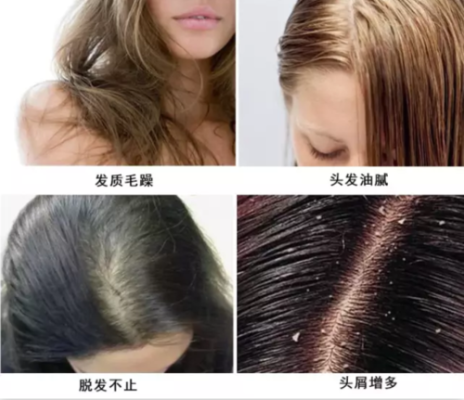 经常染头发对身体有危害吗,经常染头发有什么危害