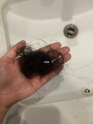 总掉头发怎么办,女生头发掉的多怎么办