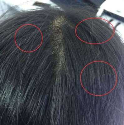 头发白是什么原因引起的,头发变白是什么原因造成的