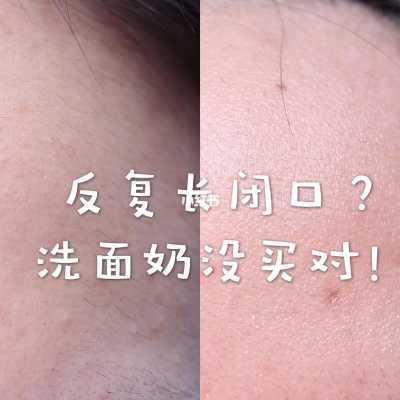 什么叫闭口（闭口是啥）