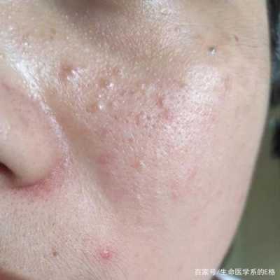 什么叫闭口（闭口是啥）