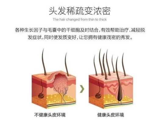 怎么护发（怎么样护发和生发）