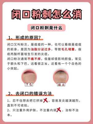 皮肤粉刺如何去除,粉刺怎么去除小妙招