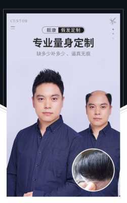 发片怎么戴（男士发片怎么戴）