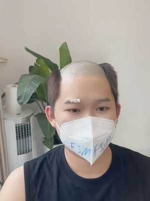 没有头发怎么办（没有头发怎么办）